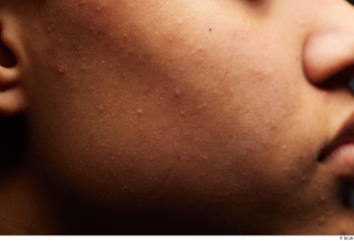 HD Face Skin Umaira cheek face skin pores skin texture…